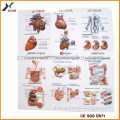 PVC Embossed Sheet 3D Embossed Human Anatomy Charts